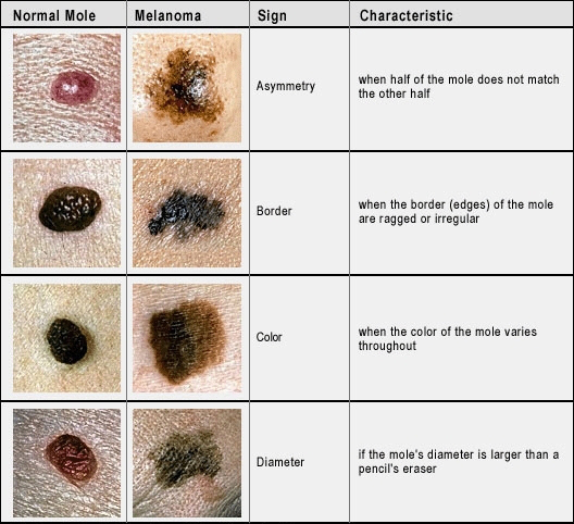 How To Fade Brown Spots | Apps Directories